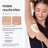 Braun Silk·expert Pro 5 IPL: Alternative to Laser Hair Removal with 4 Caps and Vanity Case, PL5347 Braun Silk·expert Pro 5 IPL: Alternative to Laser Hair Removal with 4 Caps and Vanity Case, PL5347