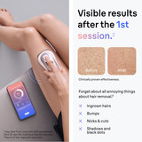 Braun Skin i·expert Smart IPL: At Home Alternative to Laser Hair Removal with 4 Caps and Vanity Case, PL7387 Braun Skin i·expert Smart IPL: At Home Alternative to Laser Hair Removal with 4 Caps and Vanity Case, PL7387